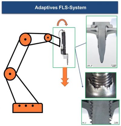 Abbildung_01IF23204N_A-FLS